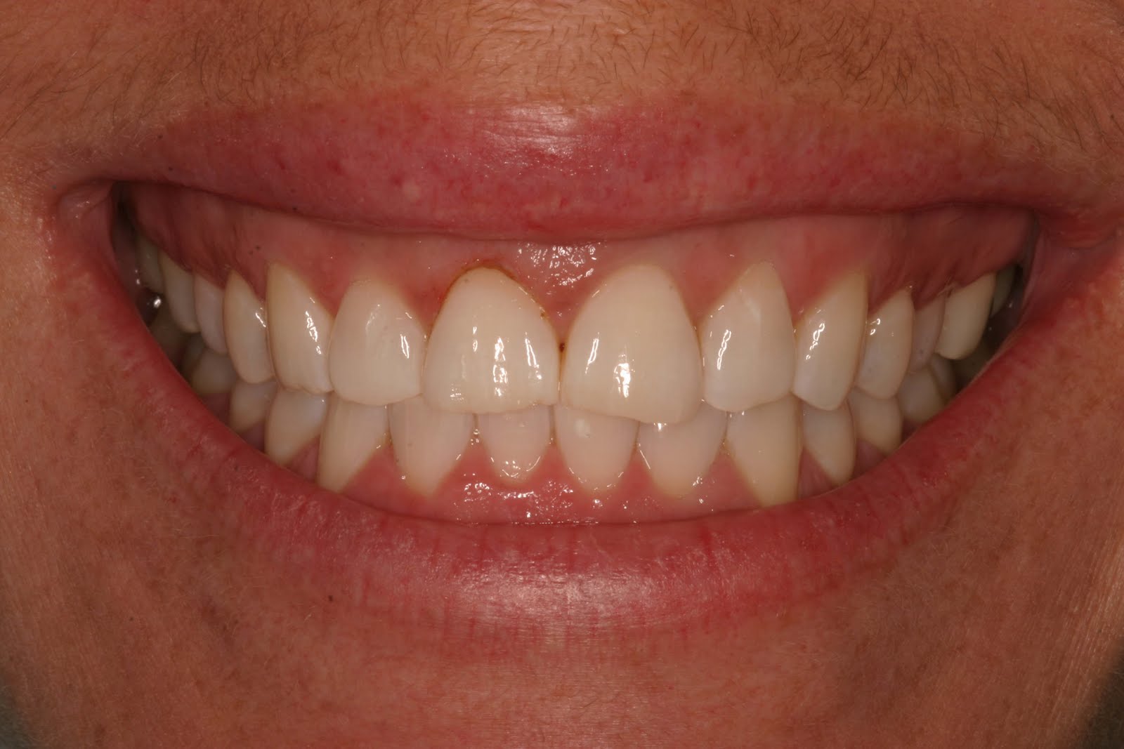 Austin Cosmetic Dentist Lakeway Dentist Dr Tejas Patel April 2010